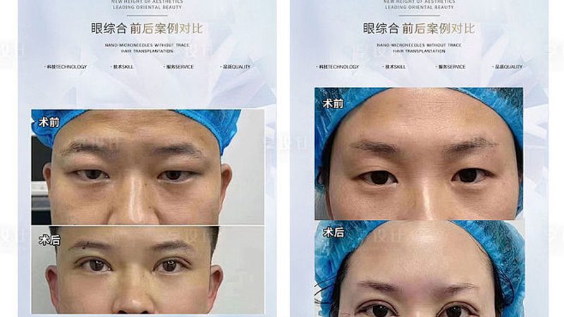 小标题：咬肌肥大，成因与影响