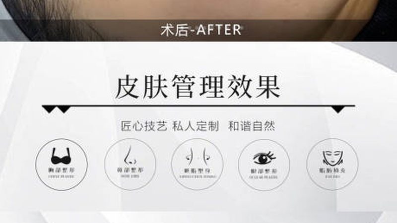 轻医美OEM定制：揭秘最小起订量的奥秘