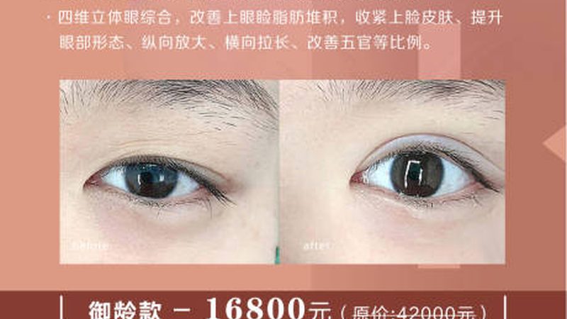 广州整形美容医院价格解析：揭秘消费与价值的平衡之道