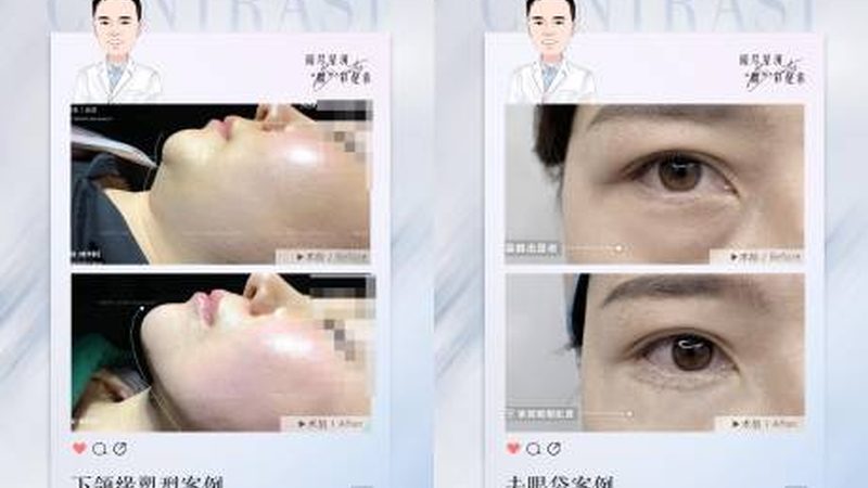 激光美容仪器定制合同：签订前必知的五大要点