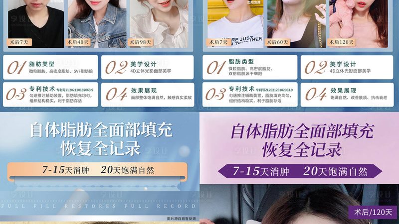揭秘上海激光美容医院口碑背后的秘密