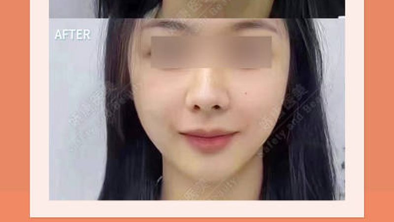 皮肤管理中心与美容院：揭秘两者本质区别