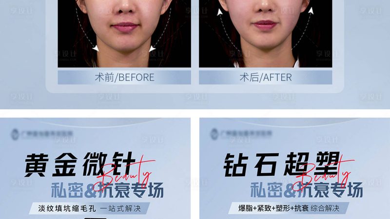 成都激光美容，揭秘优惠背后的真相