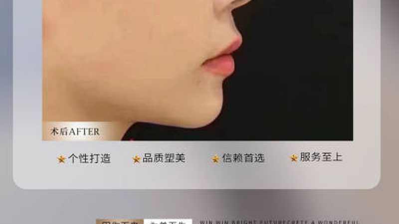 青岛下颌角手术：揭秘医生排名背后的考量因素