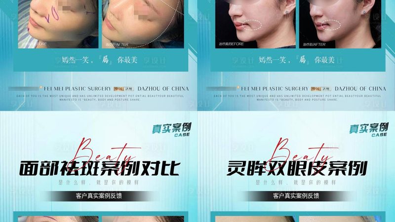 进行激光美容时，务必选择正规医疗机构，确保手术安全。关注以下信任锚点：