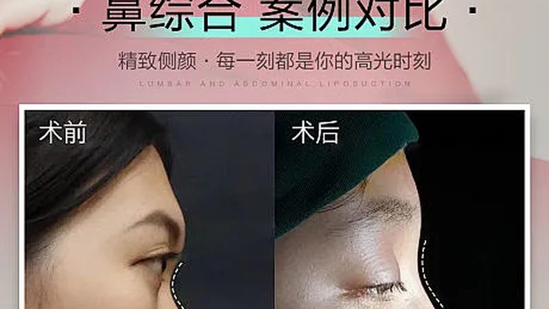 皮肤管理中心加盟培训，揭秘培训时长背后的秘密