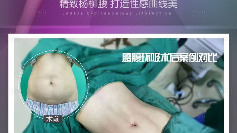 医美全麻后多久清醒？揭秘全麻恢复过程