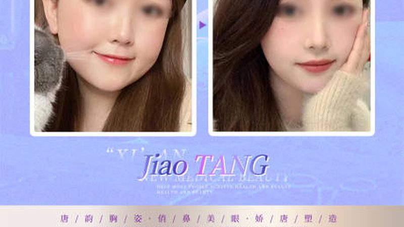 玻尿酸国产与进口：维持时间的奥秘揭秘