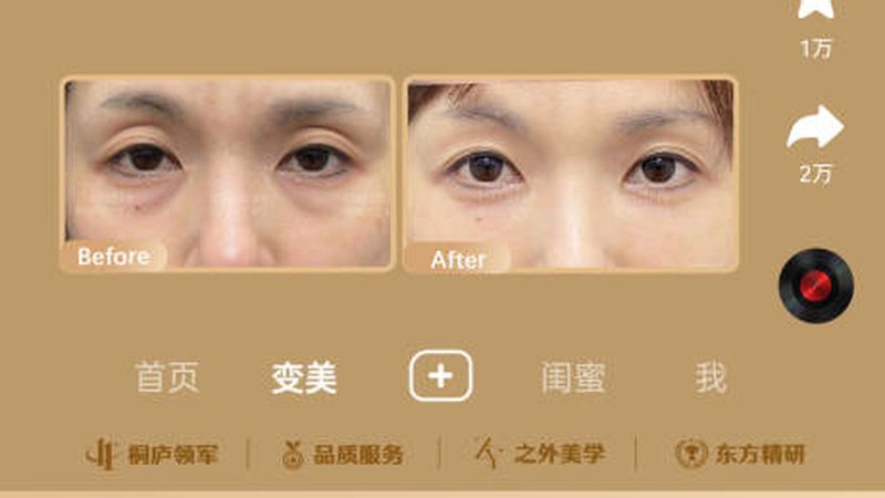 上海水光针注射后，效果显现的奥秘